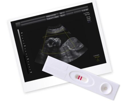 tehotensky-test-ultrazvuk-tehotenstvi