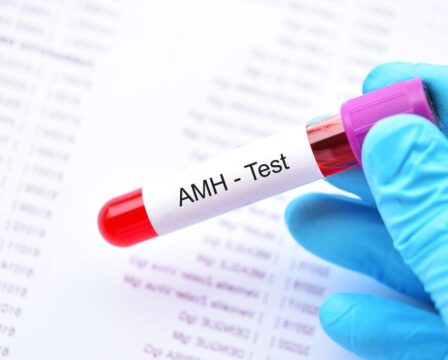 AMH test